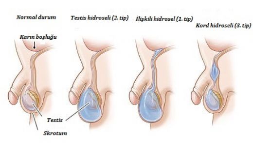 Kk Testis