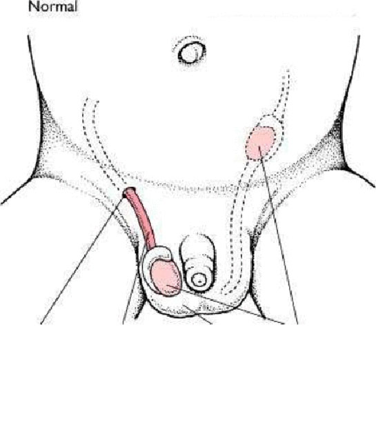 nmemi Testis