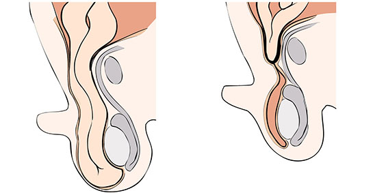 Testis Ft