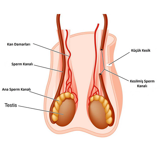 Testis Nedir