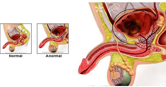 Testis Tmr